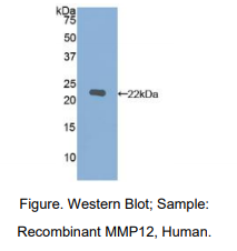 https://msimg.bioon.com/bionline/goods-no-pic.png