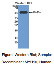 https://msimg.bioon.com/bionline/goods-no-pic.png