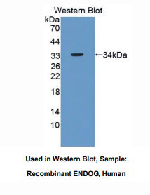 https://msimg.bioon.com/bionline/goods-no-pic.png