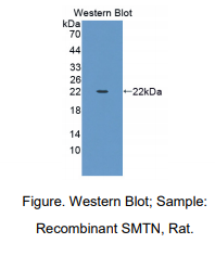 https://msimg.bioon.com/bionline/goods-no-pic.png