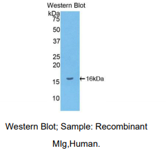 https://msimg.bioon.com/bionline/goods-no-pic.png