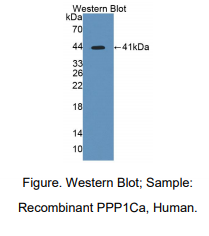 https://msimg.bioon.com/bionline/goods-no-pic.png