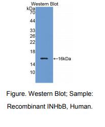 人抑制素βB(INHbB)多克隆抗体