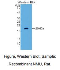 大鼠神经介素U(NMU)多克隆抗体