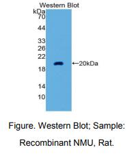 https://msimg.bioon.com/bionline/goods-no-pic.png