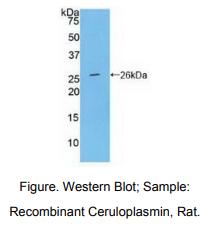 https://msimg.bioon.com/bionline/goods-no-pic.png