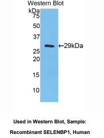 人硒结合蛋白1(SELENBP1)多克隆抗体
