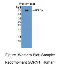 https://msimg.bioon.com/bionline/goods-no-pic.png