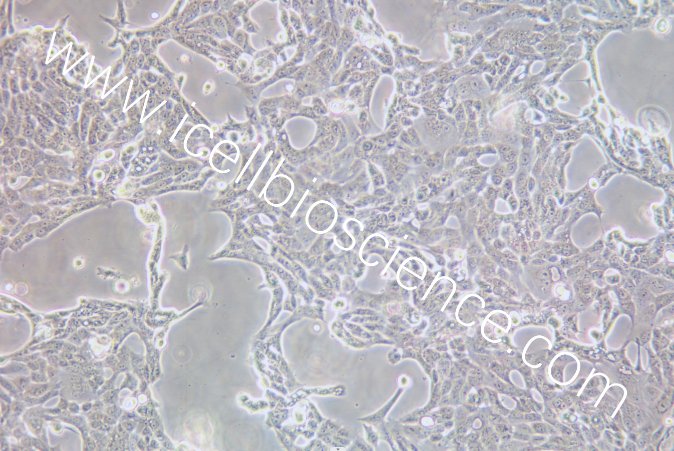 CFPAC-1/CFPAC-1/CFPAC-1/CFPAC-1/人胰腺癌细胞