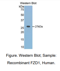 https://msimg.bioon.com/bionline/goods-no-pic.png