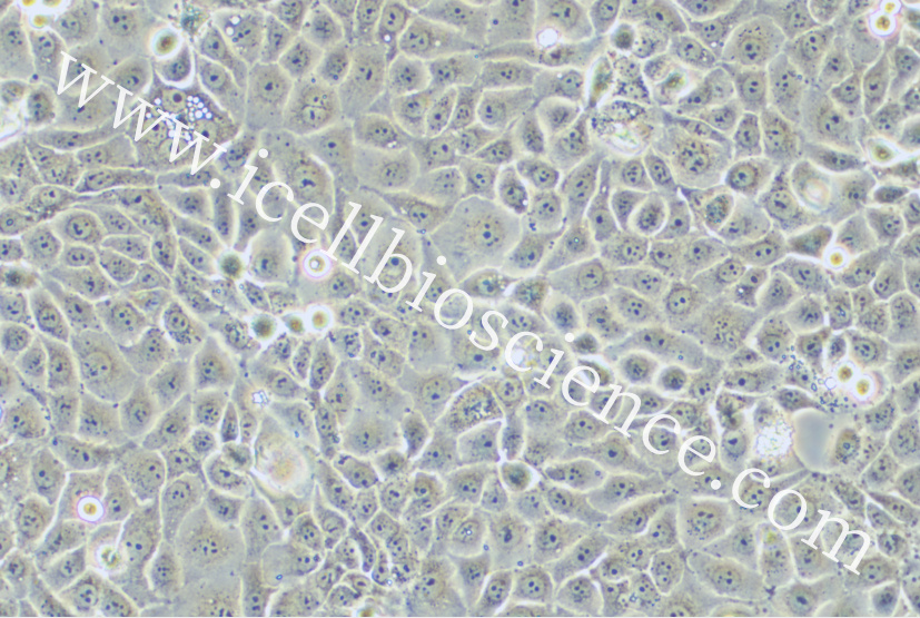ACT-1细胞/ACT1细胞/ACT-1/ACT1/人甲状腺癌细胞（未分化）