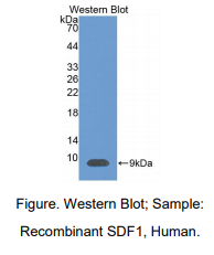 https://msimg.bioon.com/bionline/goods-no-pic.png