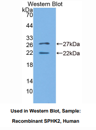 https://msimg.bioon.com/bionline/goods-no-pic.png