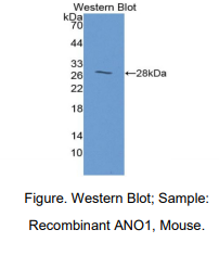 小鼠钙激活氯通道蛋白1(ANO1)多克隆抗体