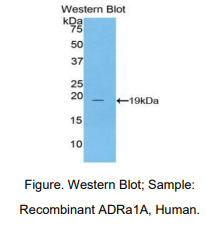 人肾上腺素能受体α1A(ADRa1A)多克隆抗体