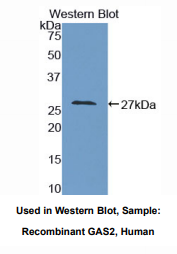 https://msimg.bioon.com/bionline/goods-no-pic.png