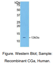 https://msimg.bioon.com/bionline/goods-no-pic.png