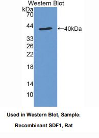 https://msimg.bioon.com/bionline/goods-no-pic.png