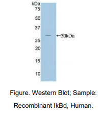 人核因子κB抑制因子δ(IkBd)多克隆抗体