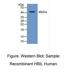 https://msimg.bioon.com/bionline/goods-no-pic.png