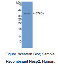 https://msimg.bioon.com/bionline/goods-no-pic.png