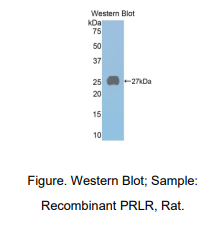 https://msimg.bioon.com/bionline/goods-no-pic.png