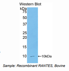 牛调节激活正常T-细胞表达分泌因子(RANTES)多克隆抗体