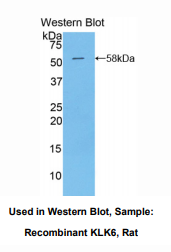 大鼠激肽释放酶6(KLK6)多克隆抗体