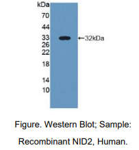 https://msimg.bioon.com/bionline/goods-no-pic.png