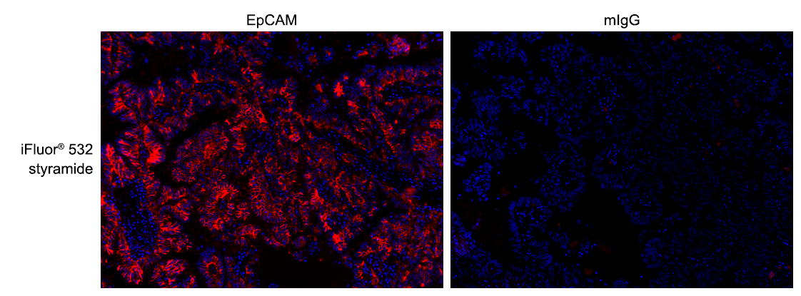 https://img.medsci.cn/e73eefcea40976357f460123cbf1e819c54e5106c9b457225be13b1cbc991aff.png