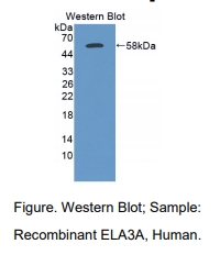 人弹性蛋白酶3A(ELA3A)多克隆抗体