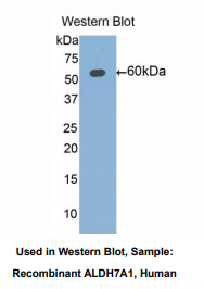 人醛脱氢酶7家族成员A1(ALDH7A1)多克隆抗体