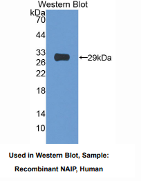 https://msimg.bioon.com/bionline/goods-no-pic.png