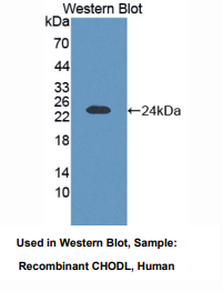 https://msimg.bioon.com/bionline/goods-no-pic.png