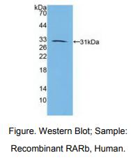人维甲酸受体β(RARb)多克隆抗体