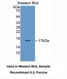 https://msimg.bioon.com/bionline/goods-no-pic.png