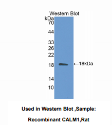 https://msimg.bioon.com/bionline/goods-no-pic.png