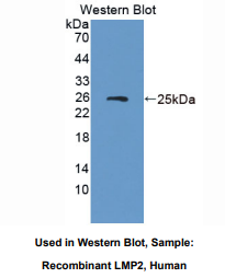 https://msimg.bioon.com/bionline/goods-no-pic.png