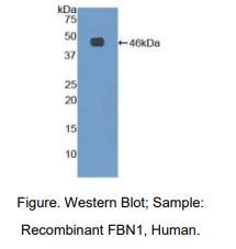 https://msimg.bioon.com/bionline/goods-no-pic.png