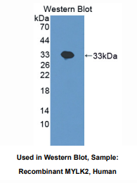 https://msimg.bioon.com/bionline/goods-no-pic.png