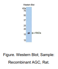 https://msimg.bioon.com/bionline/goods-no-pic.png