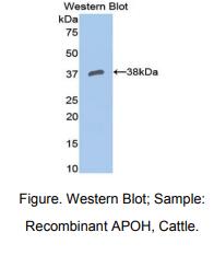 https://msimg.bioon.com/bionline/goods-no-pic.png