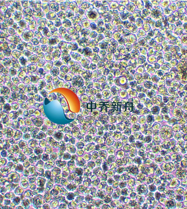 https://img.medsci.cn/8eee53bbc4cb7a98de615e72115896bc4e27fda5cbb764dbd67d9d641c2bb46a.png