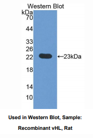 大鼠视网膜血管瘤肿瘤抑制因子(vHL)多克隆抗体