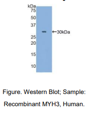 人肌球蛋白重链3(MYH3)多克隆抗体