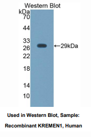 人含环状结构跨膜蛋白1(KREMEN1)多克隆抗体