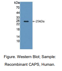 人钙磷蛋白(CAPS)多克隆抗体