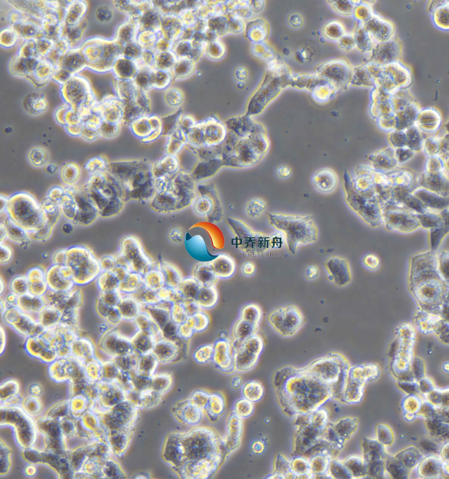 https://img.medsci.cn/8eee53bbc4cb7a98de615e72115896bc4e27fda5cbb764dbd67d9d641c2bb46a.png
