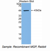 兔基质Gla蛋白(MGP)多克隆抗体