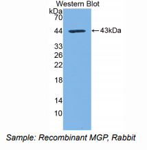 https://msimg.bioon.com/bionline/goods-no-pic.png